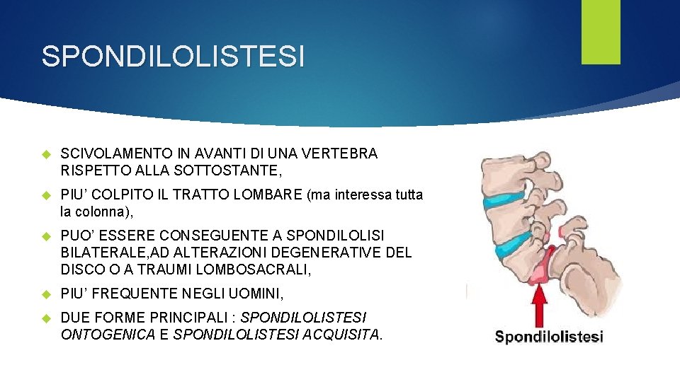 SPONDILOLISTESI SCIVOLAMENTO IN AVANTI DI UNA VERTEBRA RISPETTO ALLA SOTTOSTANTE, PIU’ COLPITO IL TRATTO