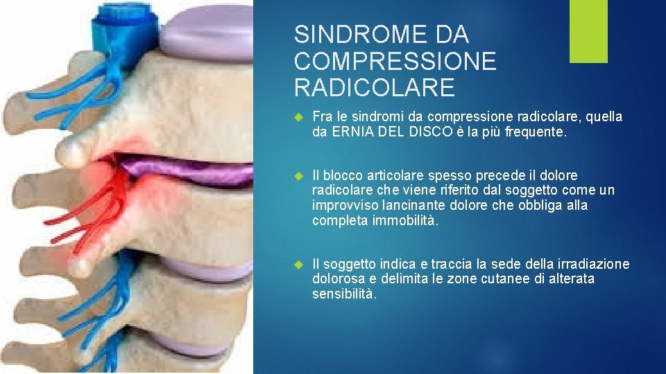 SINDROME DA COMPRESSIONE RADICOLARE Fra le sindromi da compressione radicolare, quella da ERNIA DEL