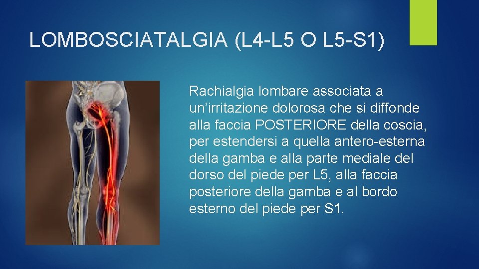 LOMBOSCIATALGIA (L 4 -L 5 O L 5 -S 1) Rachialgia lombare associata a