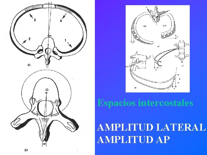 Espacios intercostales AMPLITUD LATERAL AMPLITUD AP 
