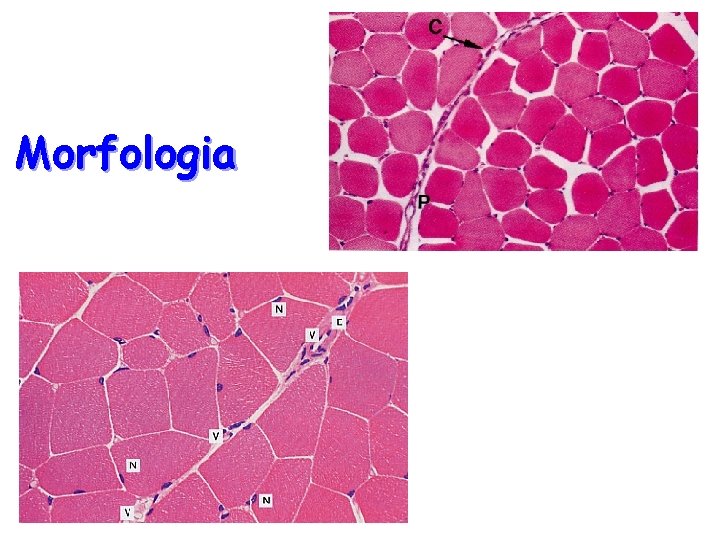 Morfologia Morfologia