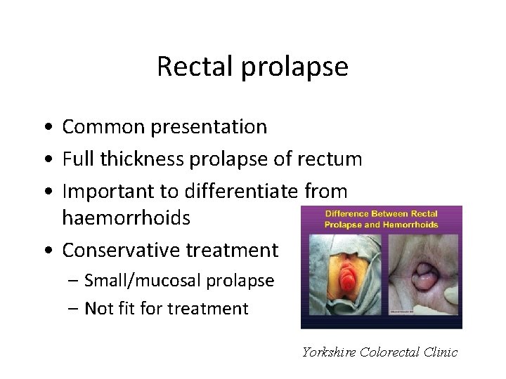 Rectal prolapse • Common presentation • Full thickness prolapse of rectum • Important to