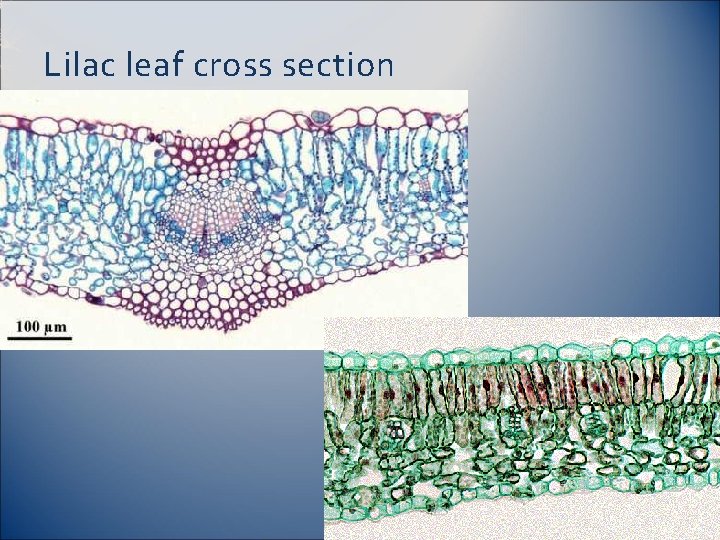 Lilac leaf cross section 