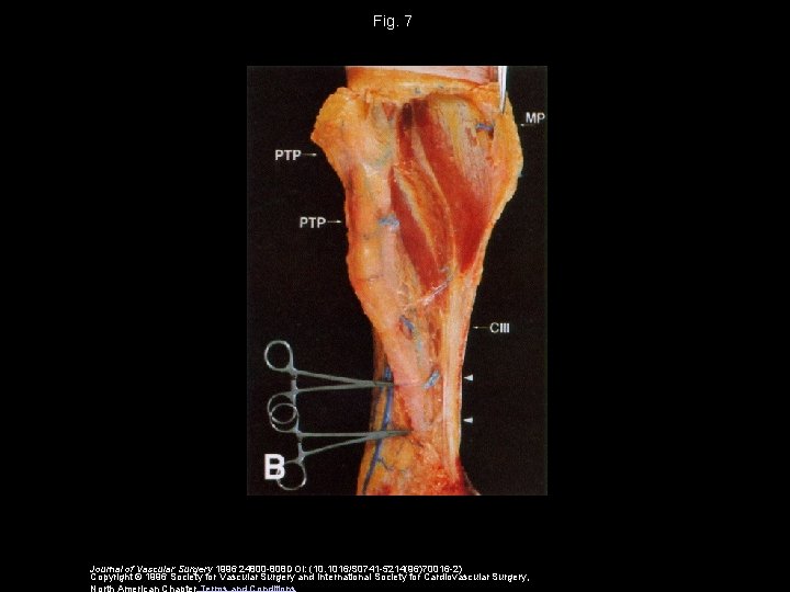 Fig. 7 Journal of Vascular Surgery 1996 24800 -808 DOI: (10. 1016/S 0741 -5214(96)70016