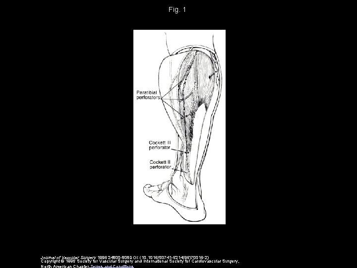 Fig. 1 Journal of Vascular Surgery 1996 24800 -808 DOI: (10. 1016/S 0741 -5214(96)70016