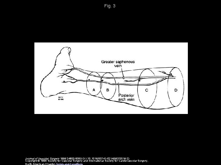 Fig. 3 Journal of Vascular Surgery 1996 24800 -808 DOI: (10. 1016/S 0741 -5214(96)70016