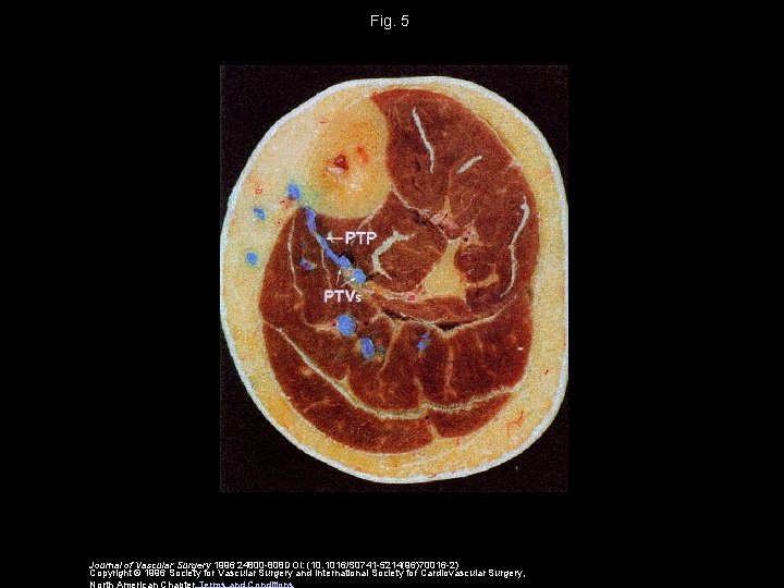 Fig. 5 Journal of Vascular Surgery 1996 24800 -808 DOI: (10. 1016/S 0741 -5214(96)70016