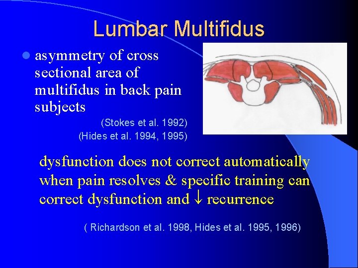 Lumbar Multifidus l asymmetry of cross sectional area of multifidus in back pain subjects