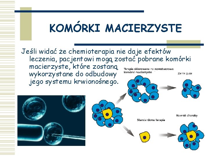 KOMÓRKI MACIERZYSTE Jeśli widać że chemioterapia nie daje efektów leczenia, pacjentowi mogą zostać pobrane