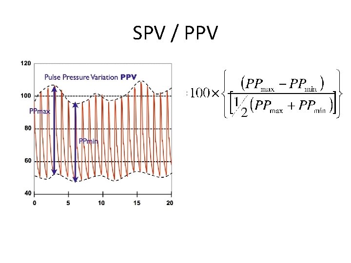 SPV / PPV 