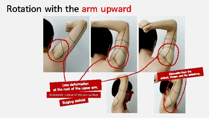 Rotation with the arm upward from the Silhouette the latissimus. n a iceps, d