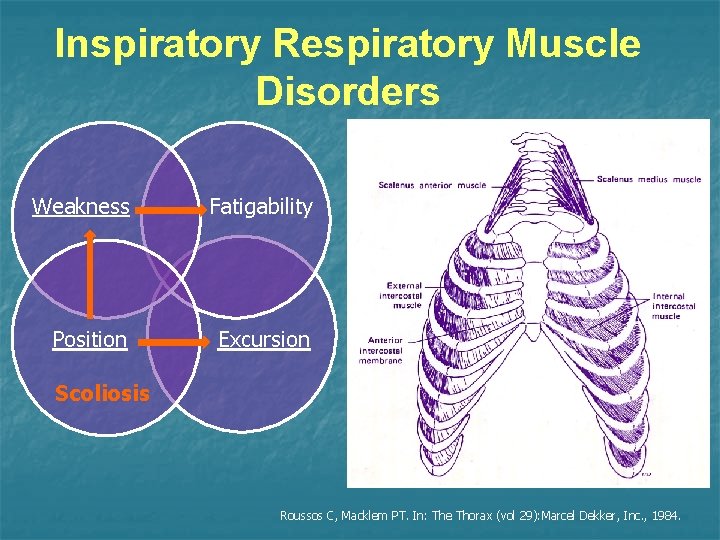 Inspiratory Respiratory Muscle Disorders Weakness Fatigability Position Excursion Scoliosis Roussos C, Macklem PT. In: