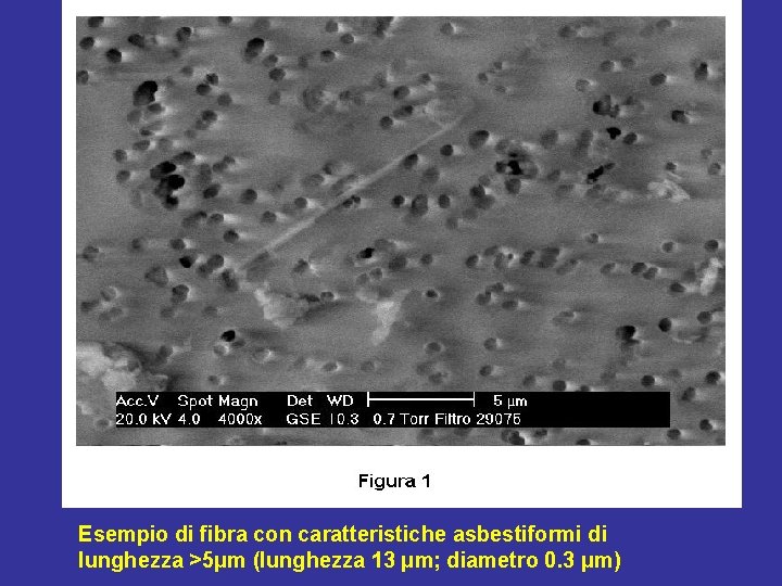 Esempio di fibra con caratteristiche asbestiformi di lunghezza >5μm (lunghezza 13 μm; diametro 0.