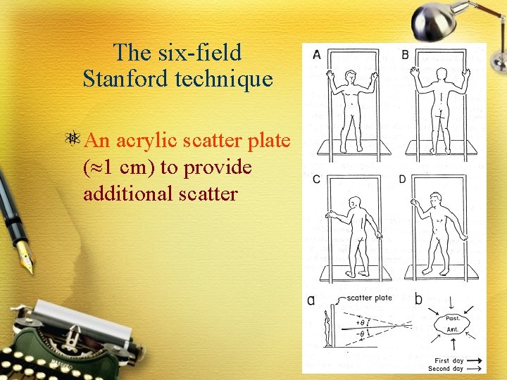 The six-field Stanford technique An acrylic scatter plate ( 1 cm) to provide additional