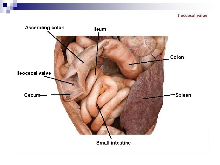 Ascending colon Ileum Colon Ileocecal valve Cecum Spleen Small intestine 