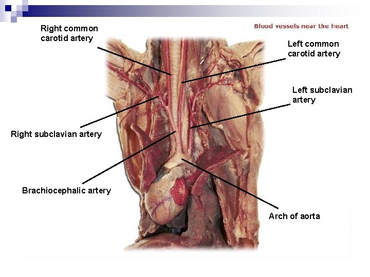 Right common carotid artery Left subclavian artery Right subclavian artery Brachiocephalic artery Arch of