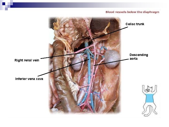 Celiac trunk Right renal vein Inferior vena cava Descending aorta 