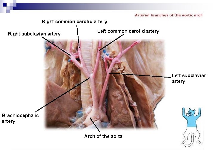 Right common carotid artery Right subclavian artery Left common carotid artery Left subclavian artery