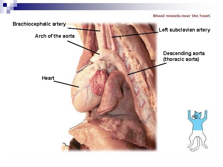 Brachiocephalic artery Left subclavian artery Arch of the aorta Descending aorta (thoracic aorta) Heart