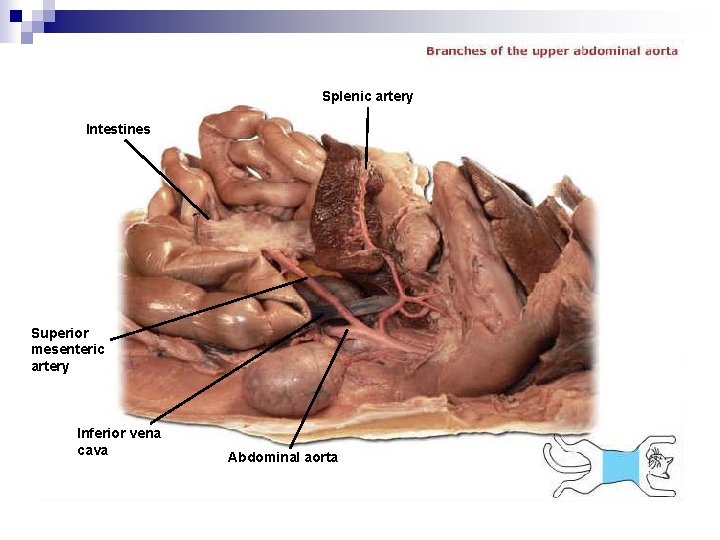 Splenic artery Intestines Superior mesenteric artery Inferior vena cava Abdominal aorta 