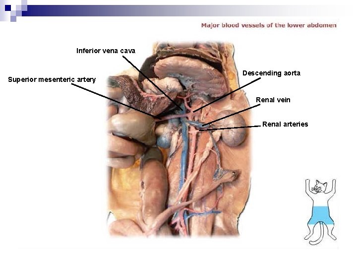 Inferior vena cava Superior mesenteric artery Descending aorta Renal vein Renal arteries 