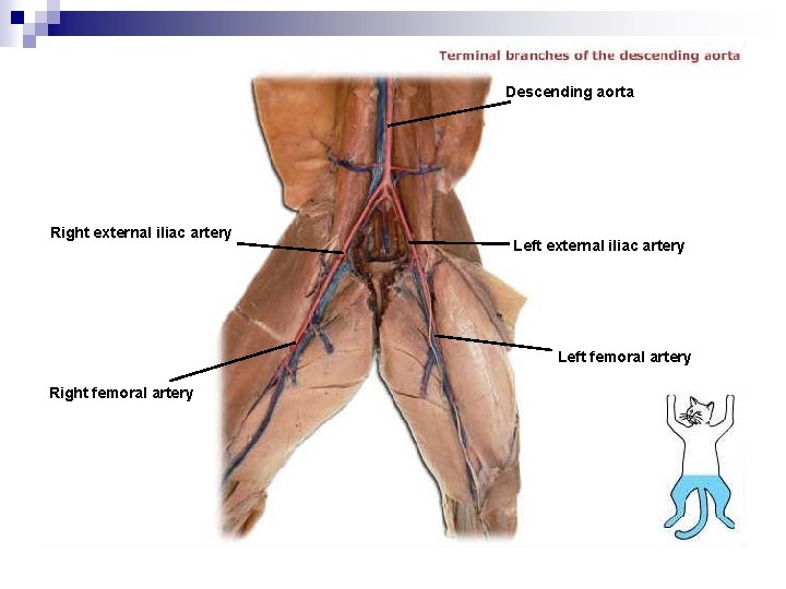 Descending aorta Right external iliac artery Left femoral artery Right femoral artery 