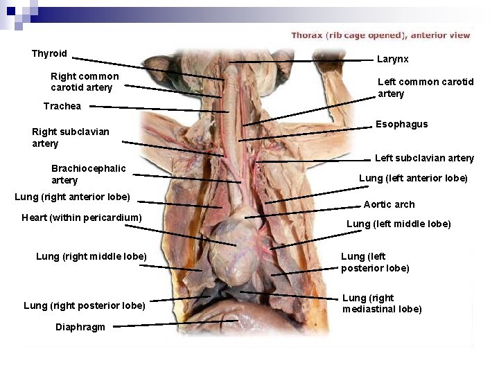 Thyroid Right common carotid artery Larynx Left common carotid artery Trachea Right subclavian artery