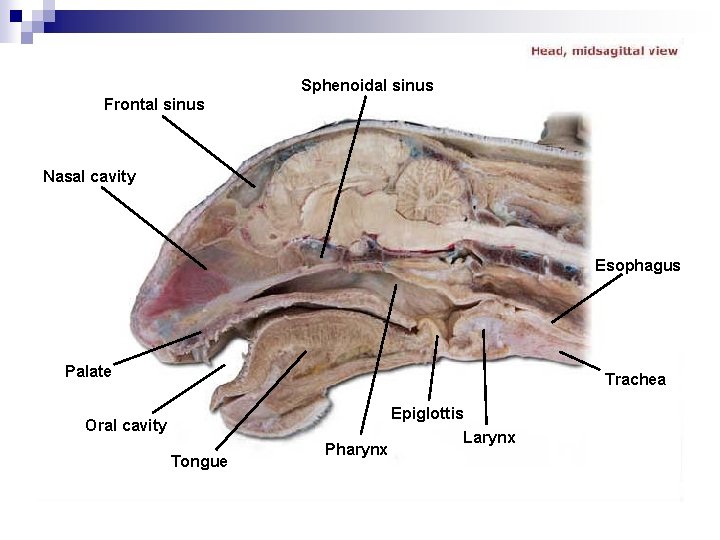 Sphenoidal sinus Frontal sinus Nasal cavity Esophagus Palate Trachea Oral cavity Tongue Pharynx Epiglottis