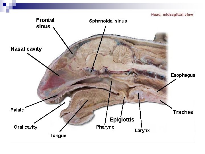 Frontal sinus Sphenoidal sinus Nasal cavity Esophagus Palate Trachea Epiglottis Oral cavity Pharynx Tongue