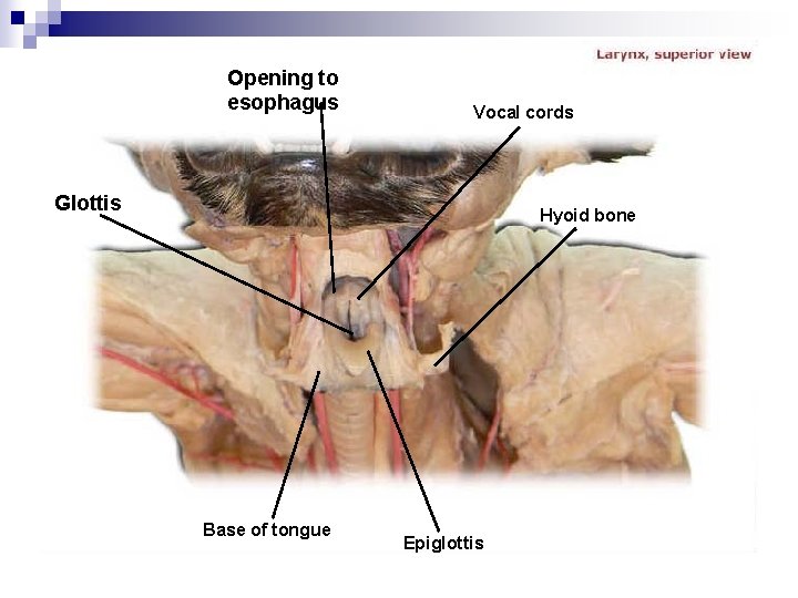 Opening to esophagus Vocal cords Glottis Hyoid bone Base of tongue Epiglottis 