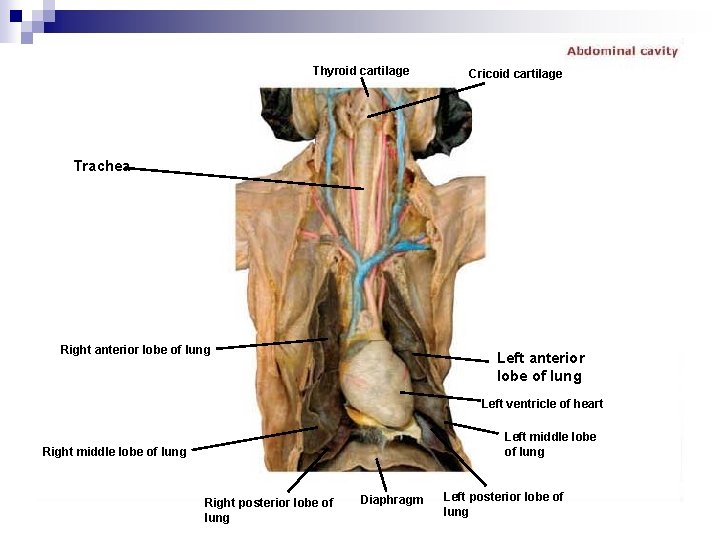 Thyroid cartilage Cricoid cartilage Trachea Right anterior lobe of lung Left ventricle of heart