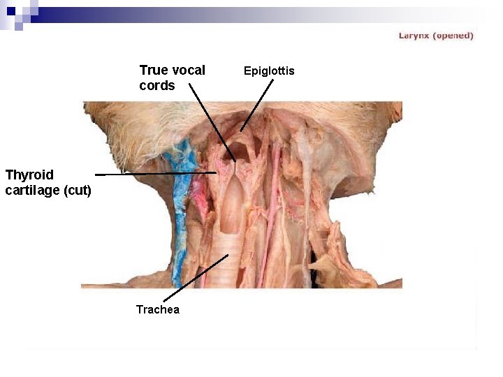 True vocal cords Thyroid cartilage (cut) Trachea Epiglottis 