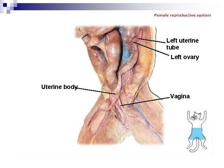 Left uterine tube Left ovary Uterine body Vagina 