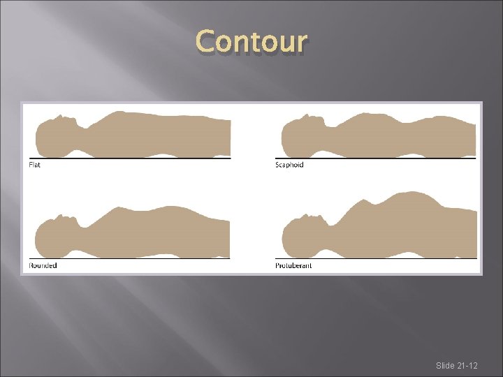 Contour Slide 21 -12 