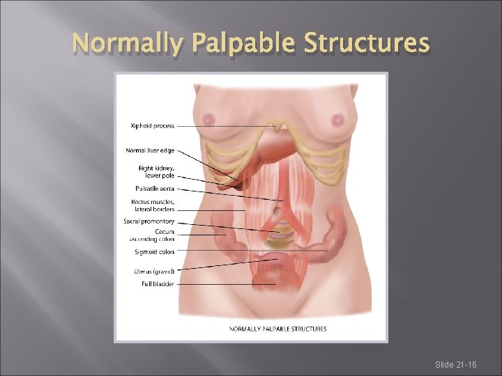 Normally Palpable Structures Slide 21 -16 