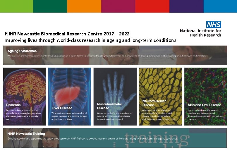 NIHR Newcastle Biomedical Research Centre 2017 – 2022 Improving lives through world-class research in