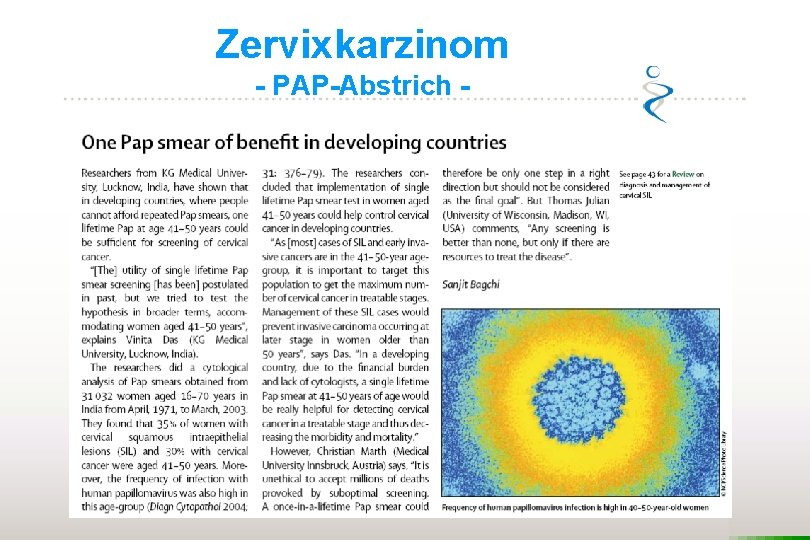 Zervixkarzinom - PAP-Abstrich - 