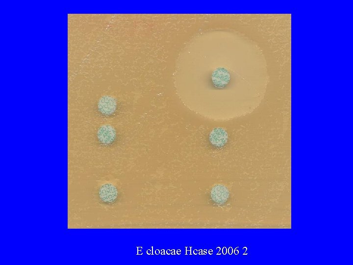  E cloacae Hcase 2006 2 