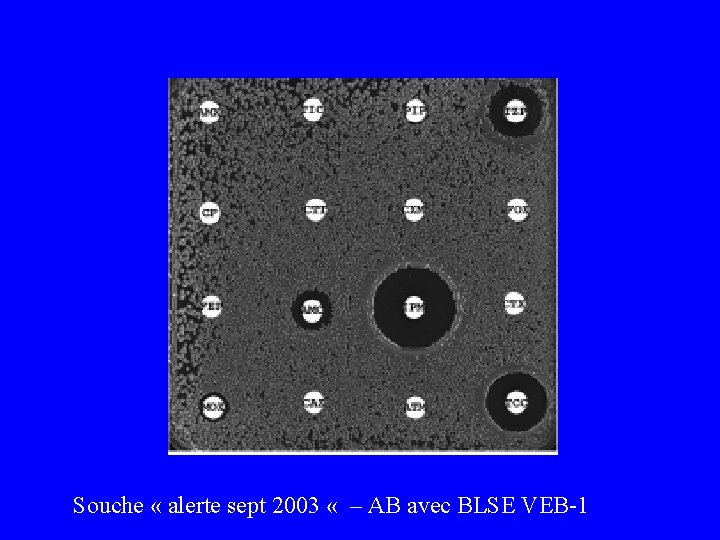 Souche « alerte sept 2003 « – AB avec BLSE VEB-1 