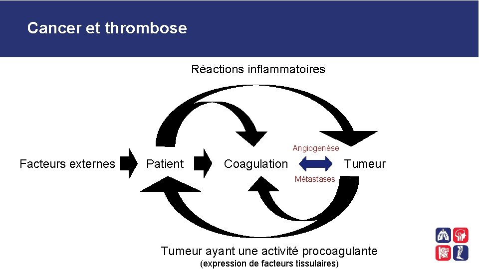 Cancer et thrombose Réactions inflammatoires Angiogenèse Facteurs externes Patient Coagulation Tumeur Métastases Tumeur ayant