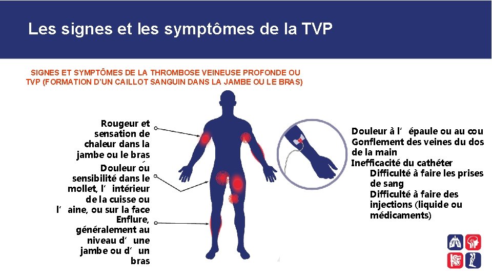 Les signes et les symptômes de la TVP SIGNES ET SYMPTÔMES DE LA THROMBOSE