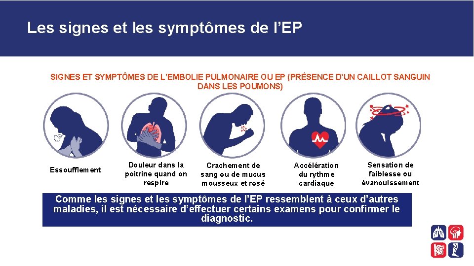 Les signes et les symptômes de l’EP SIGNES ET SYMPTÔMES DE L’EMBOLIE PULMONAIRE OU