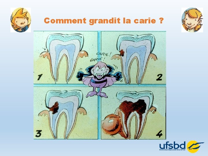 Comment grandit la carie ? 11 