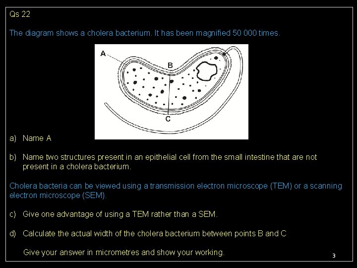 Qs 22 The diagram shows a cholera bacterium. It has been magnified 50 000