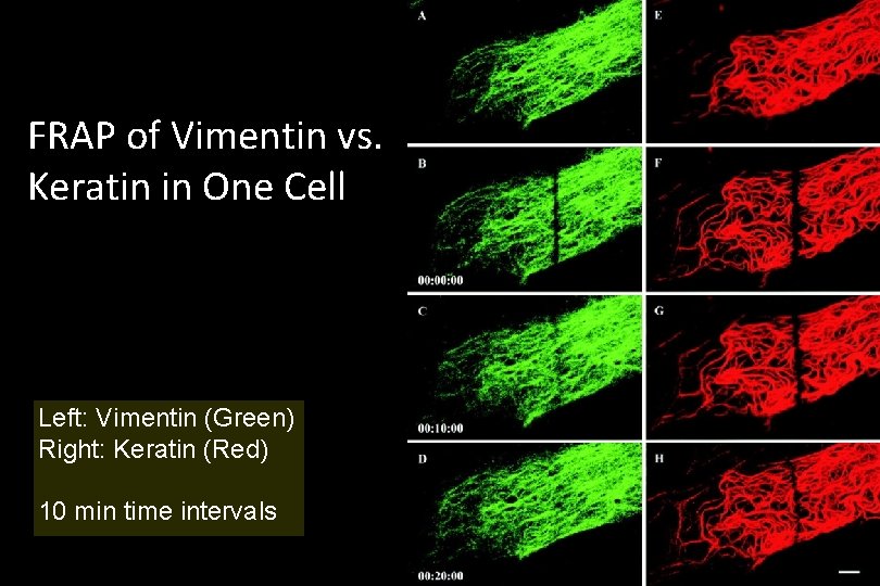 FRAP of Vimentin vs. Keratin in One Cell Left: Vimentin (Green) Right: Keratin (Red)