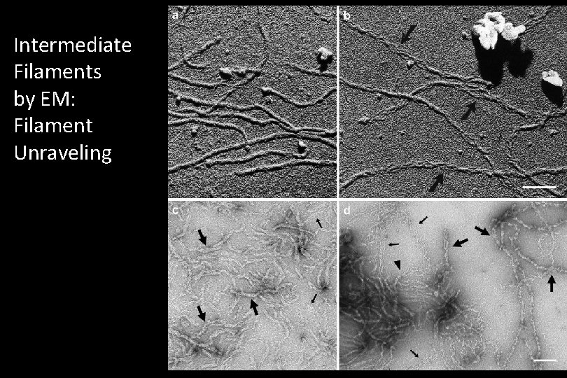 Intermediate Filaments by EM: Filament Unraveling 