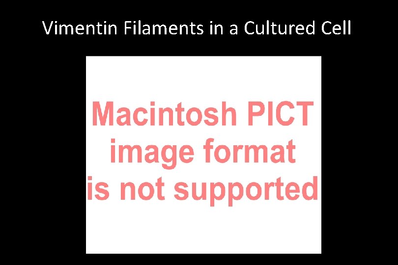 Vimentin Filaments in a Cultured Cell 
