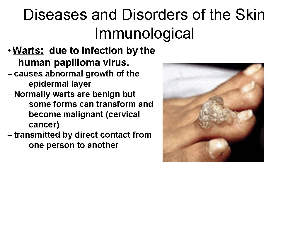 Diseases and Disorders of the Skin Immunological • Warts: due to infection by the