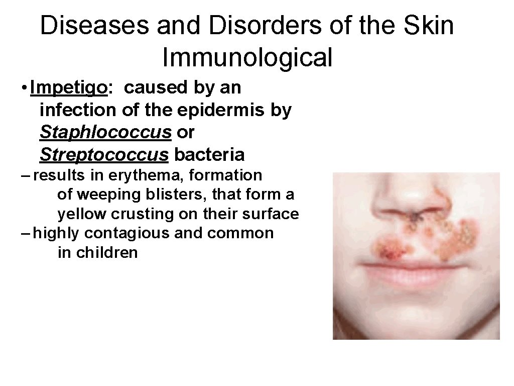 Diseases and Disorders of the Skin Immunological • Impetigo: caused by an infection of