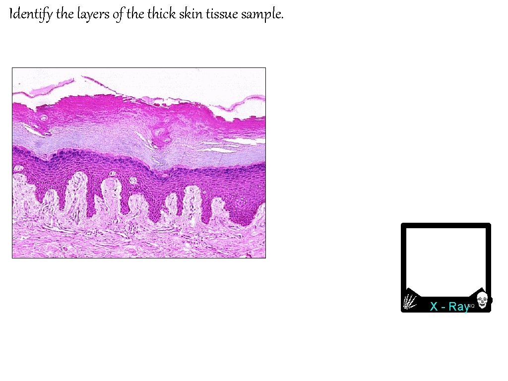 Identify the layers of the thick skin tissue sample. Stratum corneum Stratum lucidum Stratum